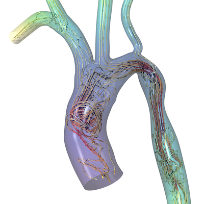 Vascular Blood Flow Simulations Accelerated on Intel® GPUs